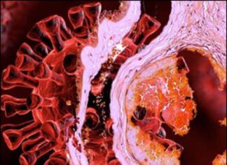 A PANDEMIC OF INEXPLICABLE CONSEQUENCES